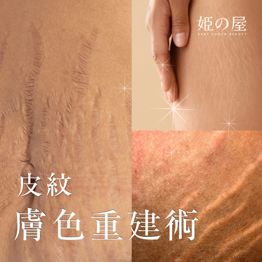 Bcb_sr 半永久膚色重建術（皮紋）