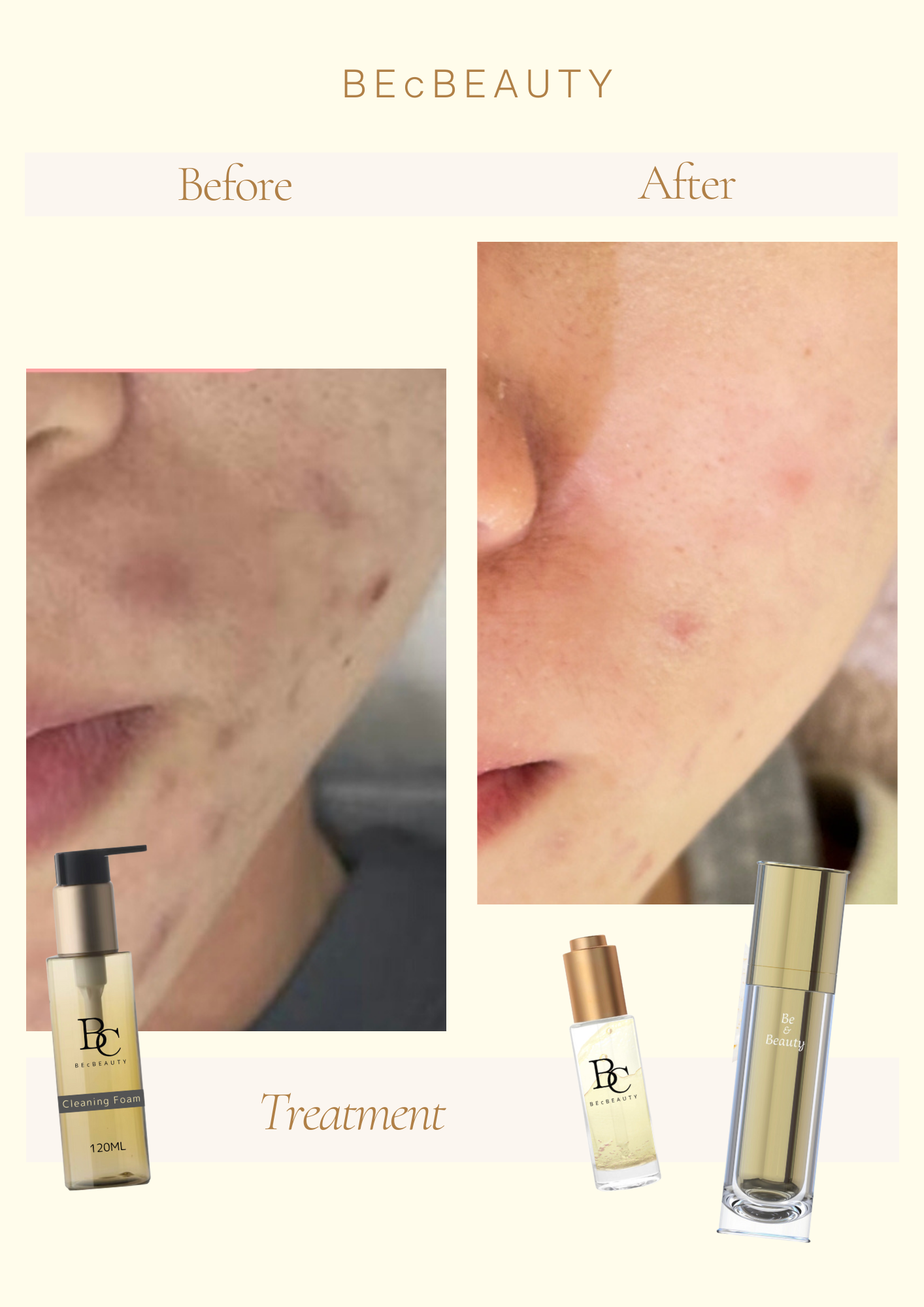 BC Becbeauty 白金酵母卸妝潔面泡（角質面膜）
